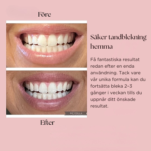 Tandblekningspenna â Kliniskt inspirerad tandblekning hemma