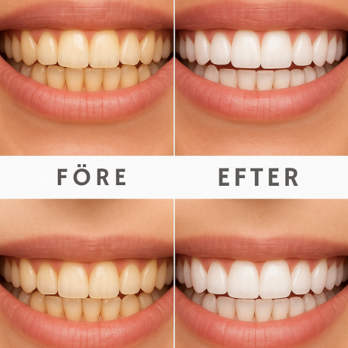 Nordic Whiteâą Remsor