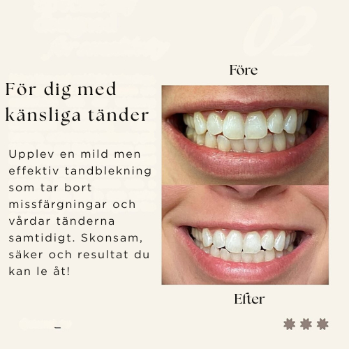 Tandblekningspenna – Kliniskt inspirerad tandblekning hemma