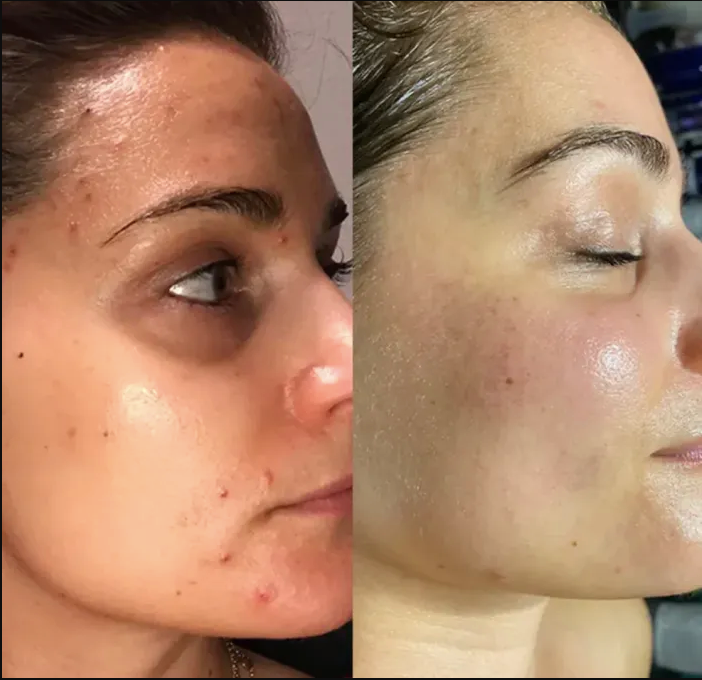 GlowLift – Rynkreducerande & Uppstramande