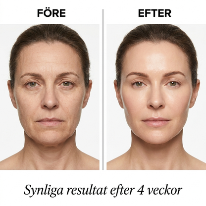 GlowLift Ansiktslyftare